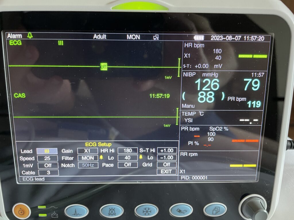 Cardiac arrest - Step 4